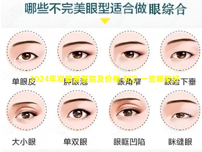 2024年双眼皮医院及价格 🦈 一览哪家好